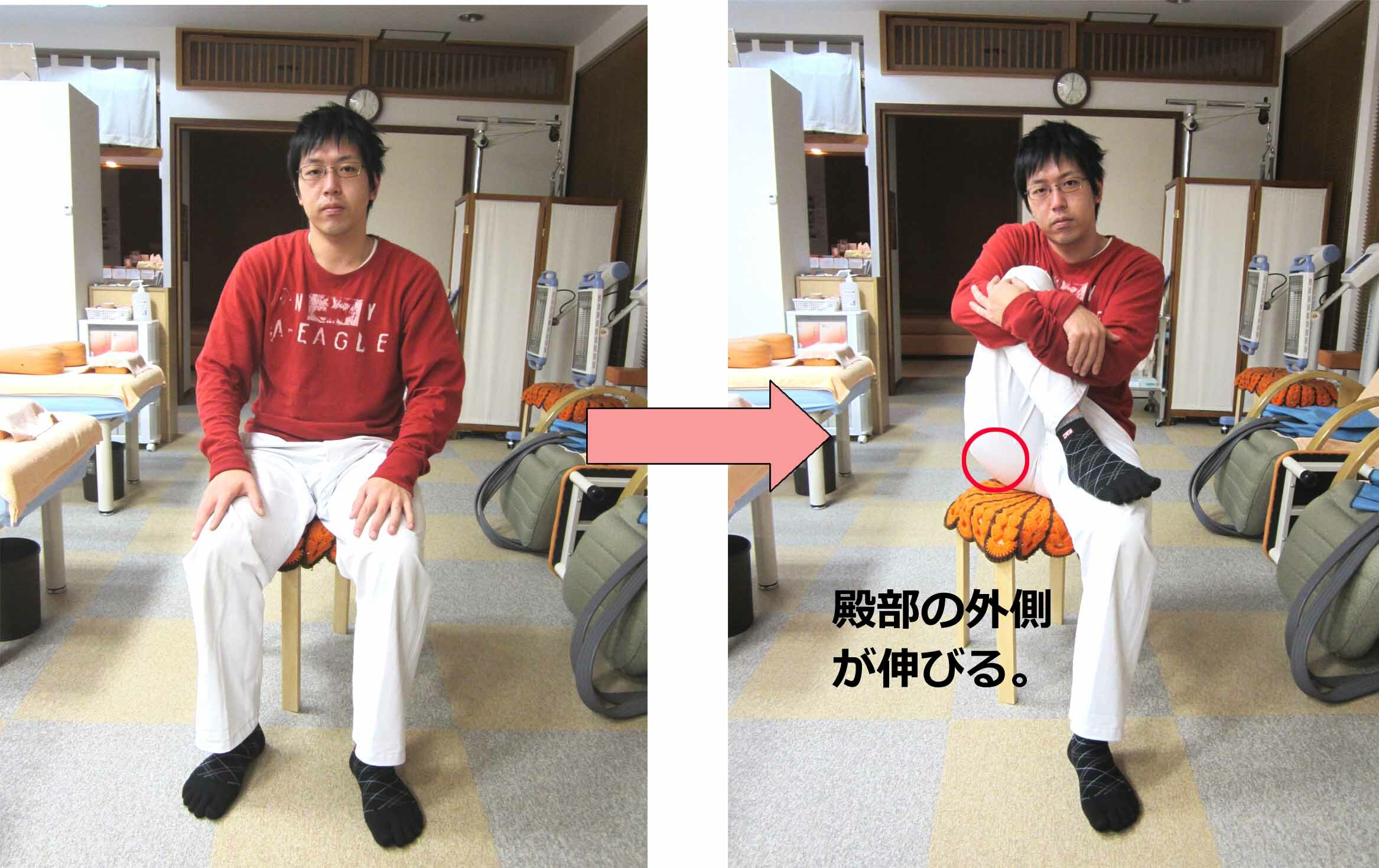坐骨 神経痛 ストレッチ 即効