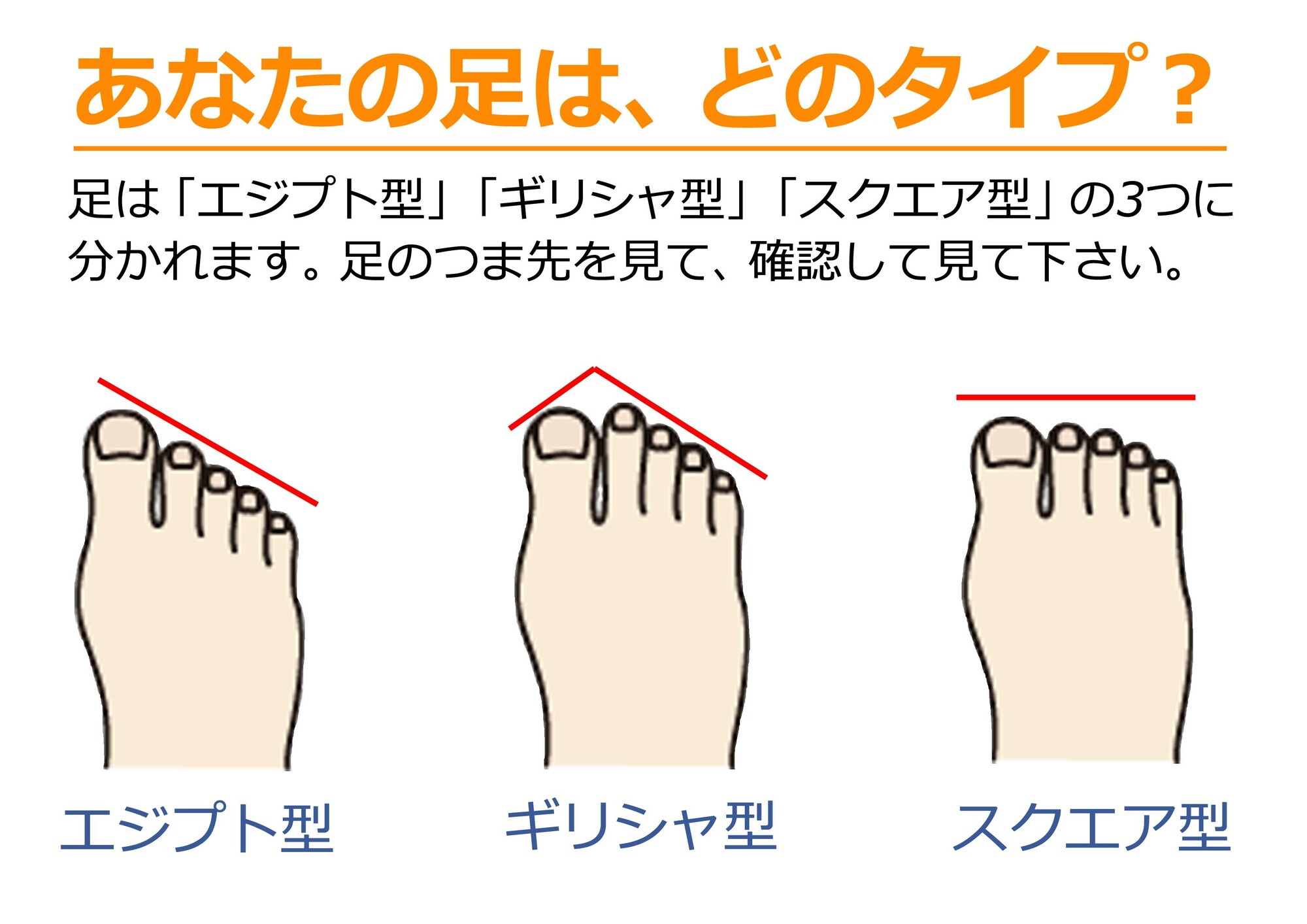 足のタイプでわかる外反母趾のリスク